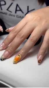Unhas 