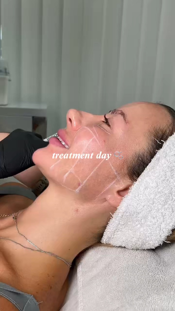 treatment day 🫧