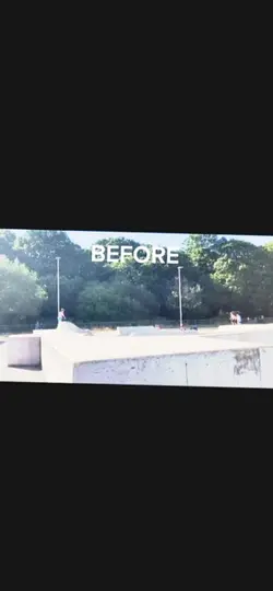 Scooter improvements