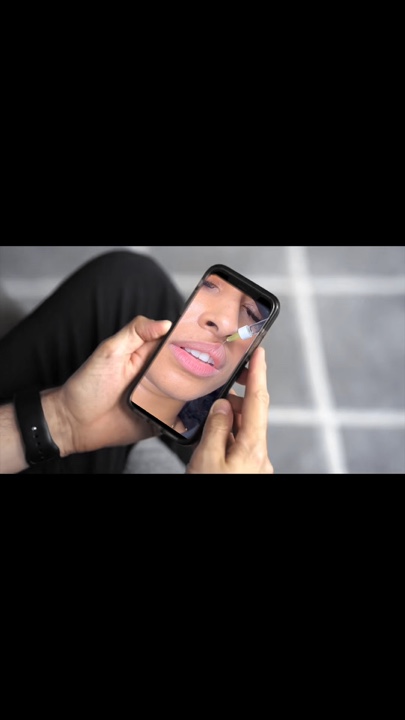 Lip filler