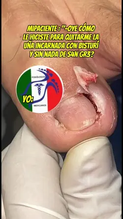 cómo le hiciste