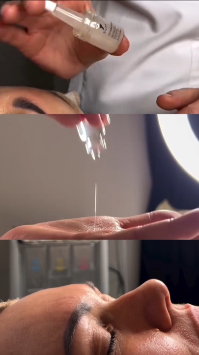 Microneedling
