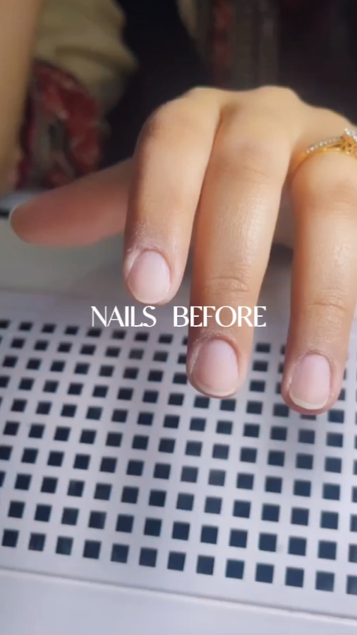 ANTES Y DESPUÉS DE LAS UÑAS