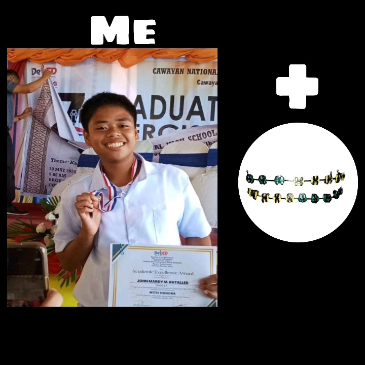 me + brace