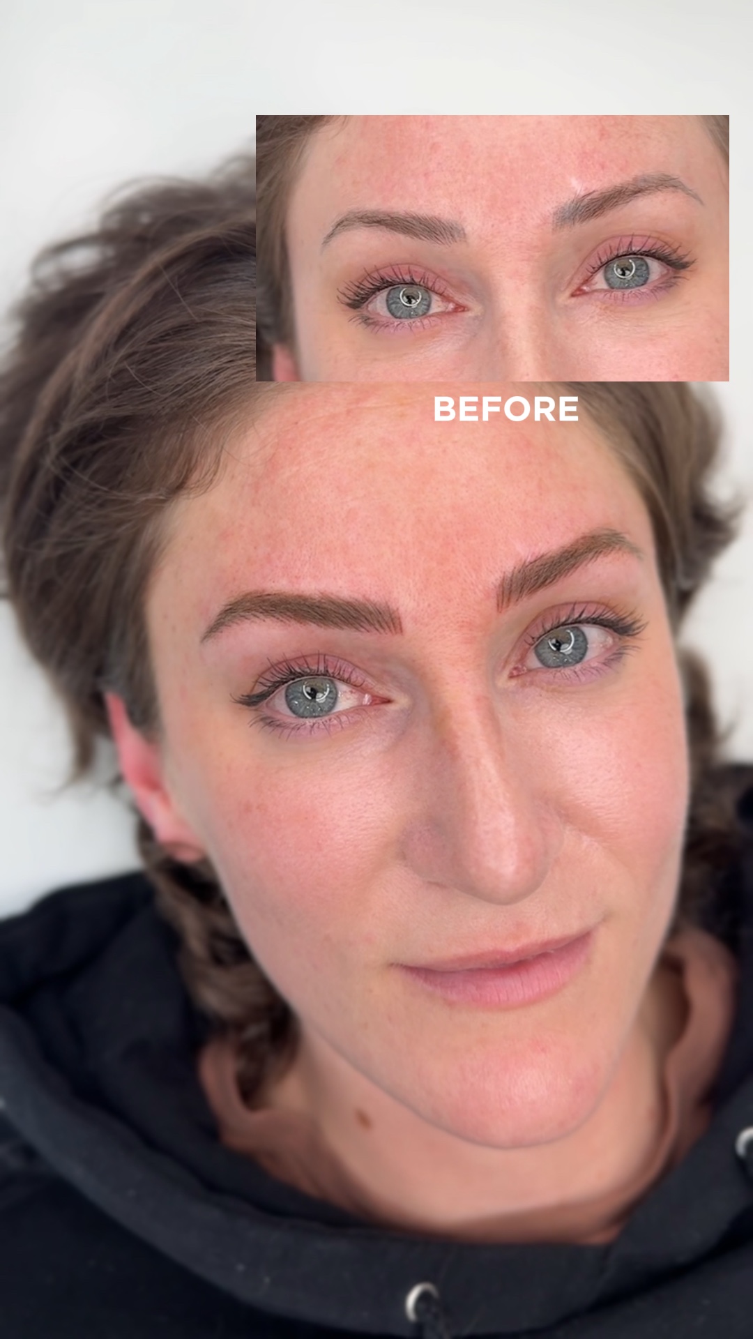 Antes Después De Las Cejas 