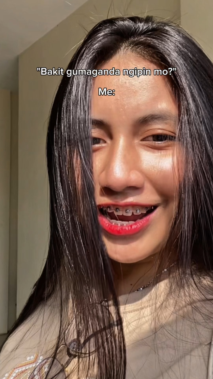 Braces Journey
