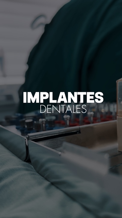 Implantes dentários 