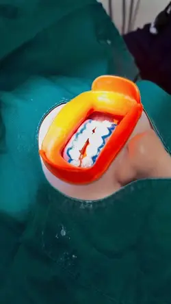 clareamento dental