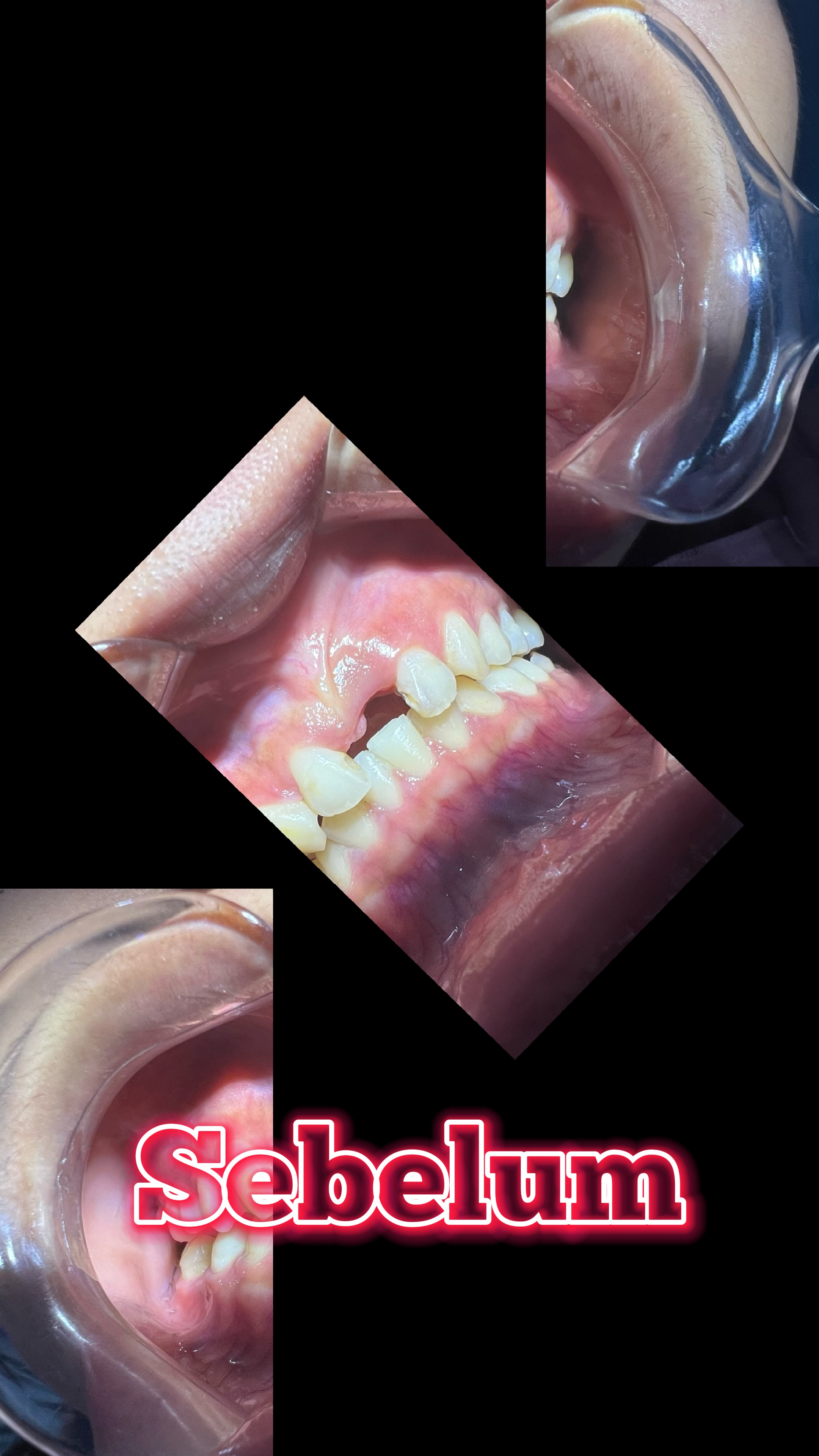 Modelo dental