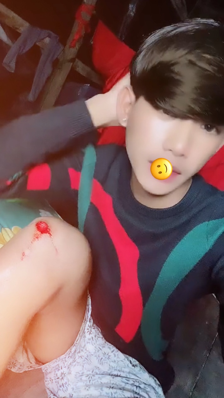 របួសក្រៅបេះដូងមិនងាប់ទេ🥹💔