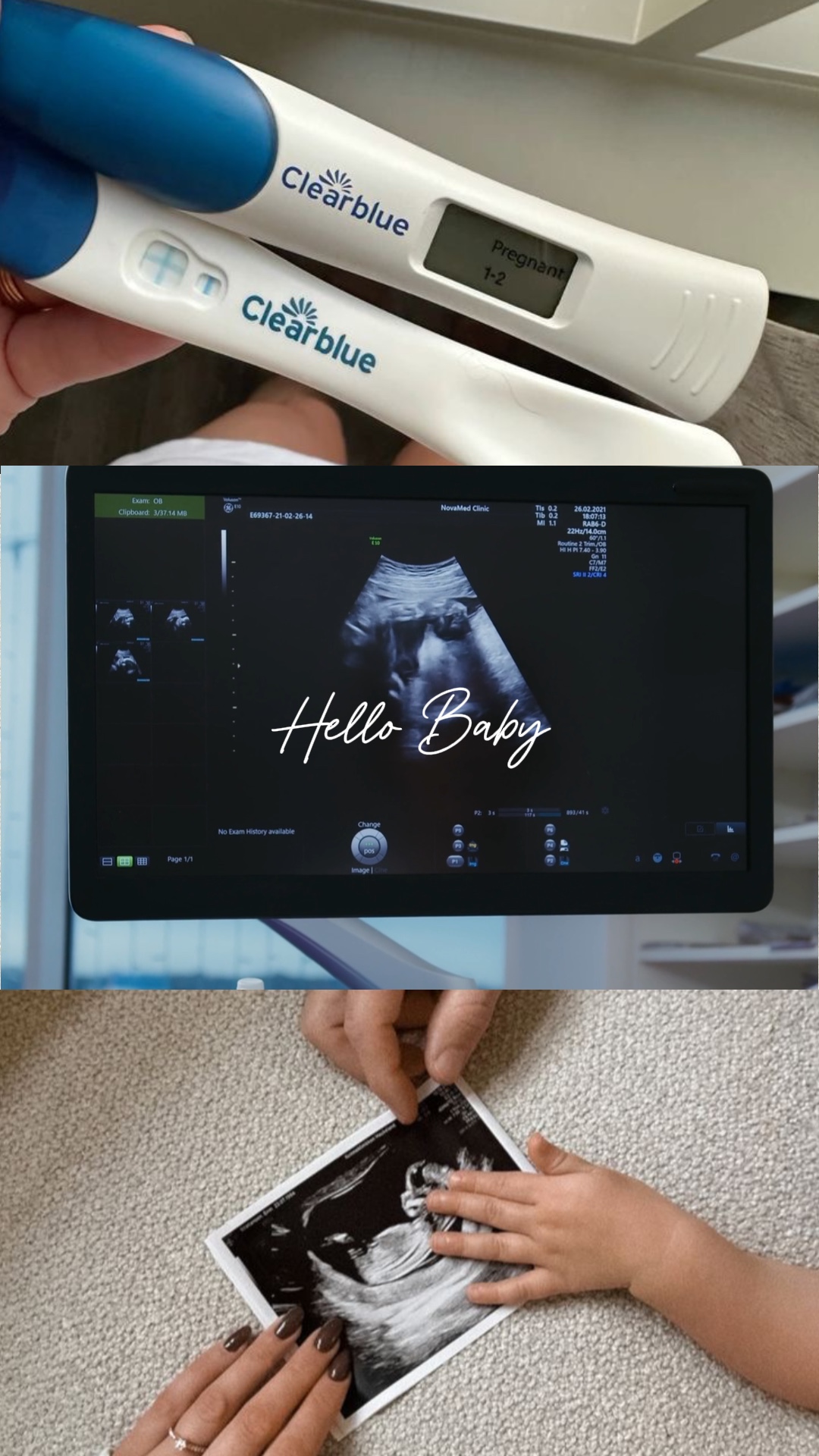 Baby template