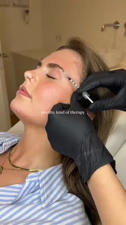 botox facial