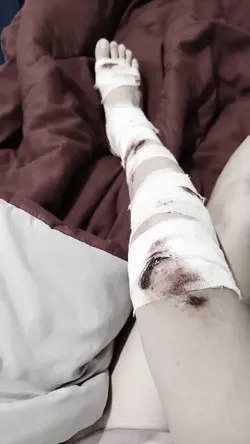 prank injury ai