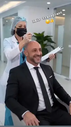 hair transplant