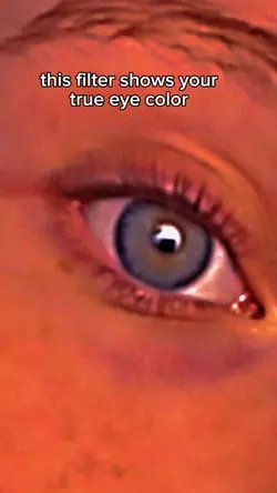 true eye color