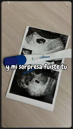 mi sorpresa 