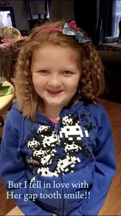 Gap tooth smile