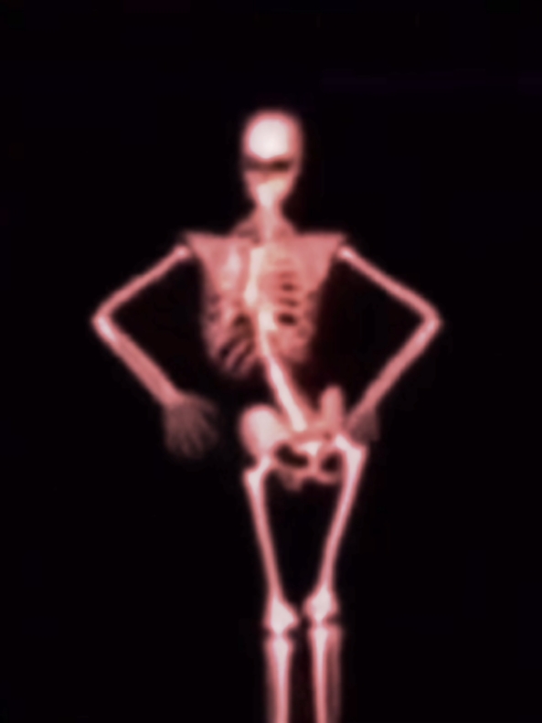 dancin skeleton edit