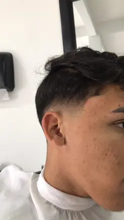 Antes e depois 