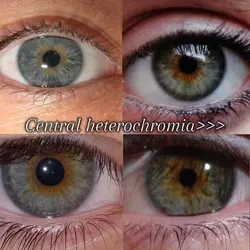 MY EYEEESSSS!!!!