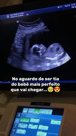 bebê mais perfeito