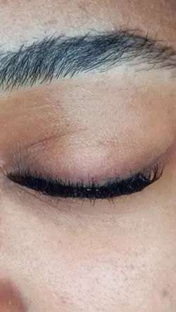 cilios 