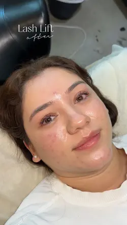 Lash Lift