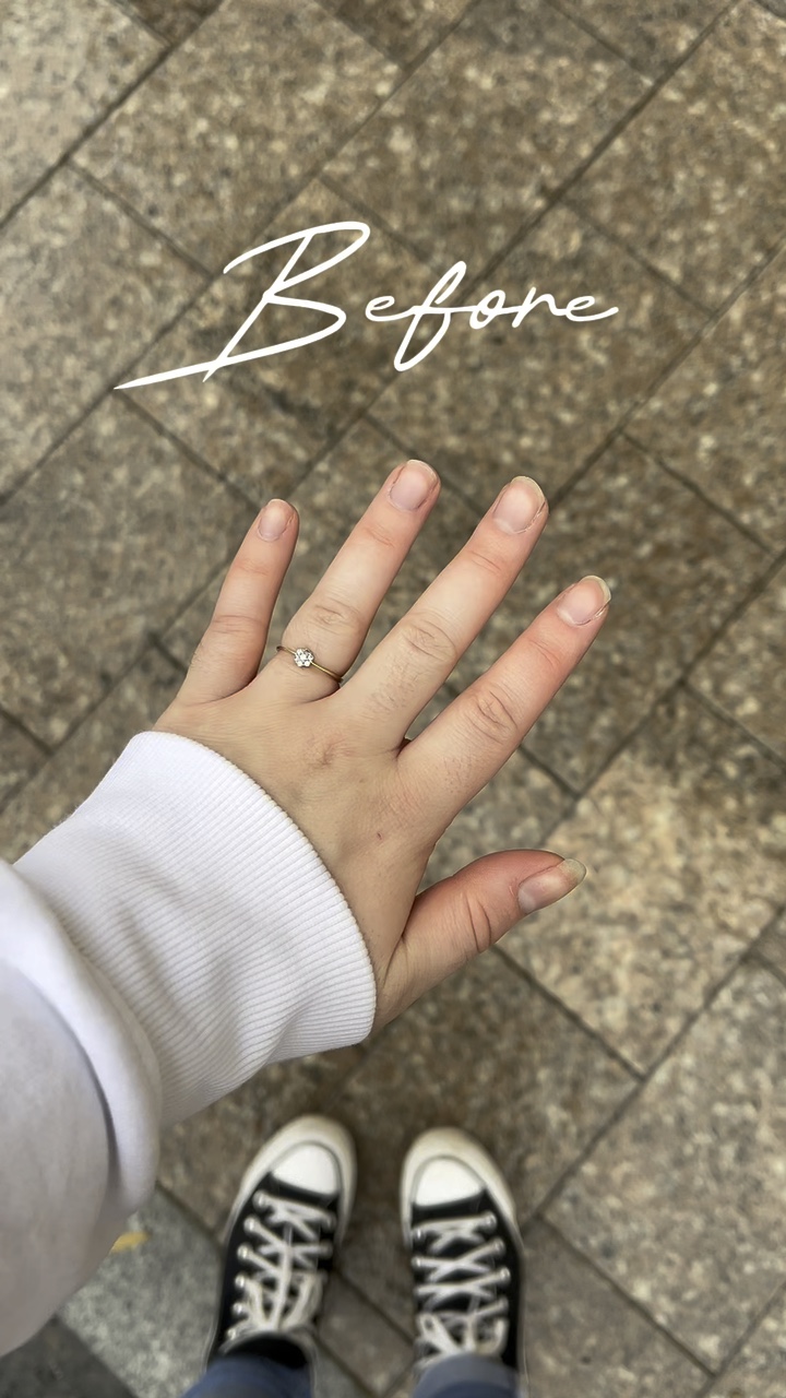 NÄGEL ÜBERGANG 