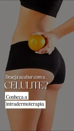 Celulite