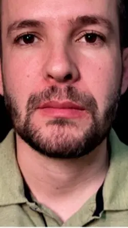 DENTISTA FACETAS