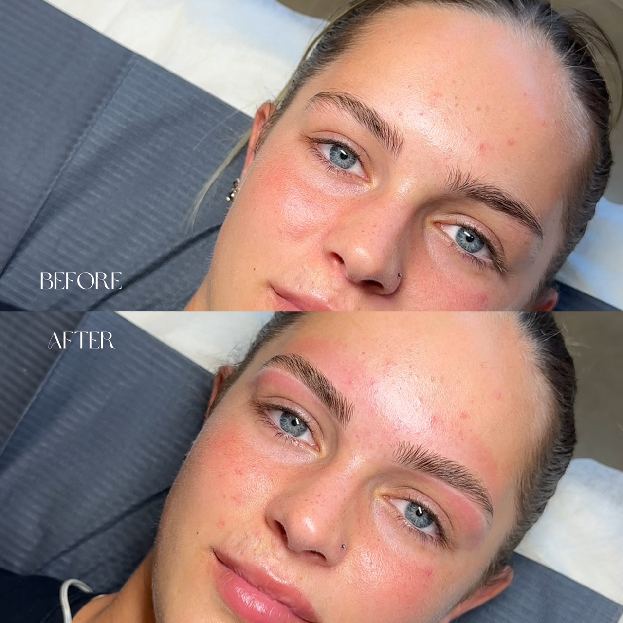Transformation