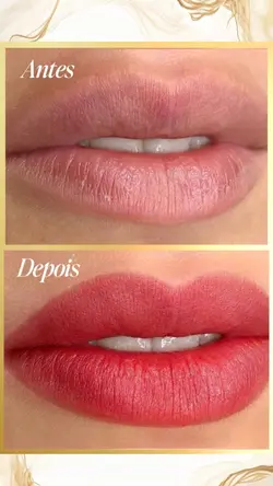 Antes e depois