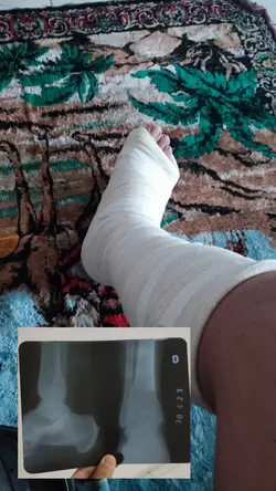 lesionado