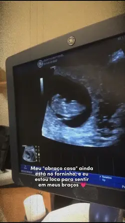 bebê no forninho