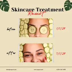 Skincare and Personal Care Before After Treatment Result