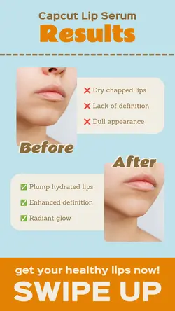 Beauty Lip Serum Before After Instagram Story