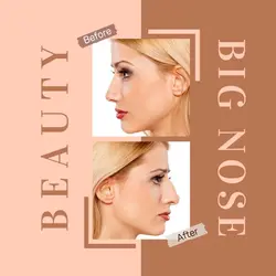 Beauty Before and After Comparison Instagram Post