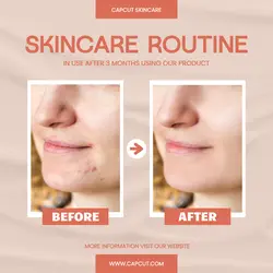 Skinkare before & after comparison insagram post