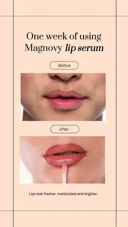 Before After Skincare Instagram Story
