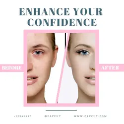 Beauty Before and After Comparison Instagram Post