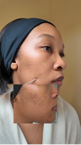 skincare UGC 